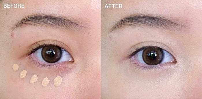 เทคนิคผิวเนียน