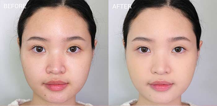 เทคนิคผิวเนียน