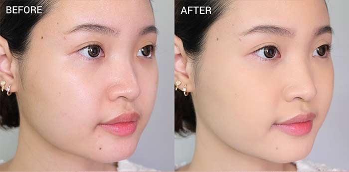 เทคนิคผิวเนียน